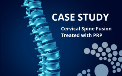 Case Study: Cervical Spine Fusion Treated with PRP